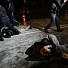 Най-малкият пациент – 16-годишно момче е със счупване на китката